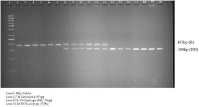 Molecular role of non-exonic variants in CALPAIN 10 gene in polycystic ovarian syndrome in Saudi women